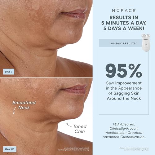 NuFACE Trinity+ Smart Advanced Facial Toning Routine, Microcurrent Device to Tone, Sculpt and Lift, Smooth Fine Lines and Wrinkles, Holiday Limited Edition